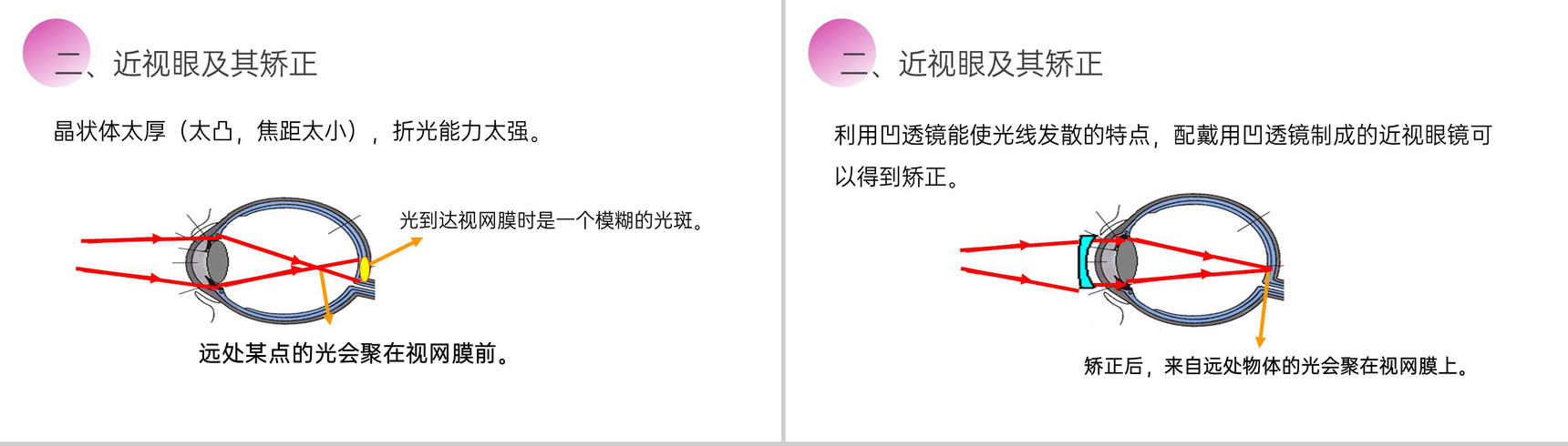 《眼睛和眼镜》人教版八年级初二物理上册PPT课件-7