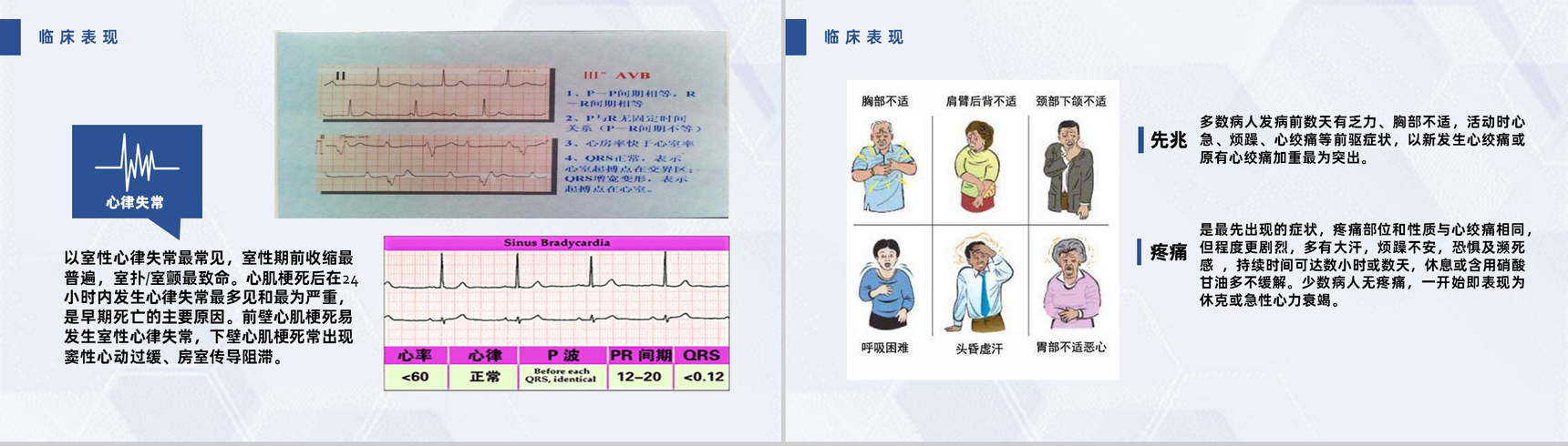 扁平化风格蓝色医疗急性心梗护理查房PPT模板-11